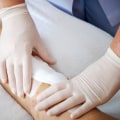 How Wound Exudate Guides Better Care and Faster Healing
