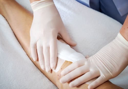 How Wound Exudate Guides Better Care and Faster Healing
