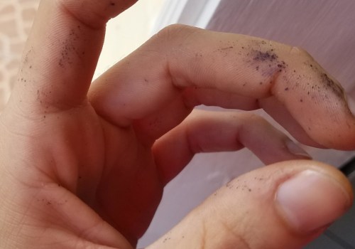 What Silver Nitrate Sticks on Skin Actually Do to Wounds